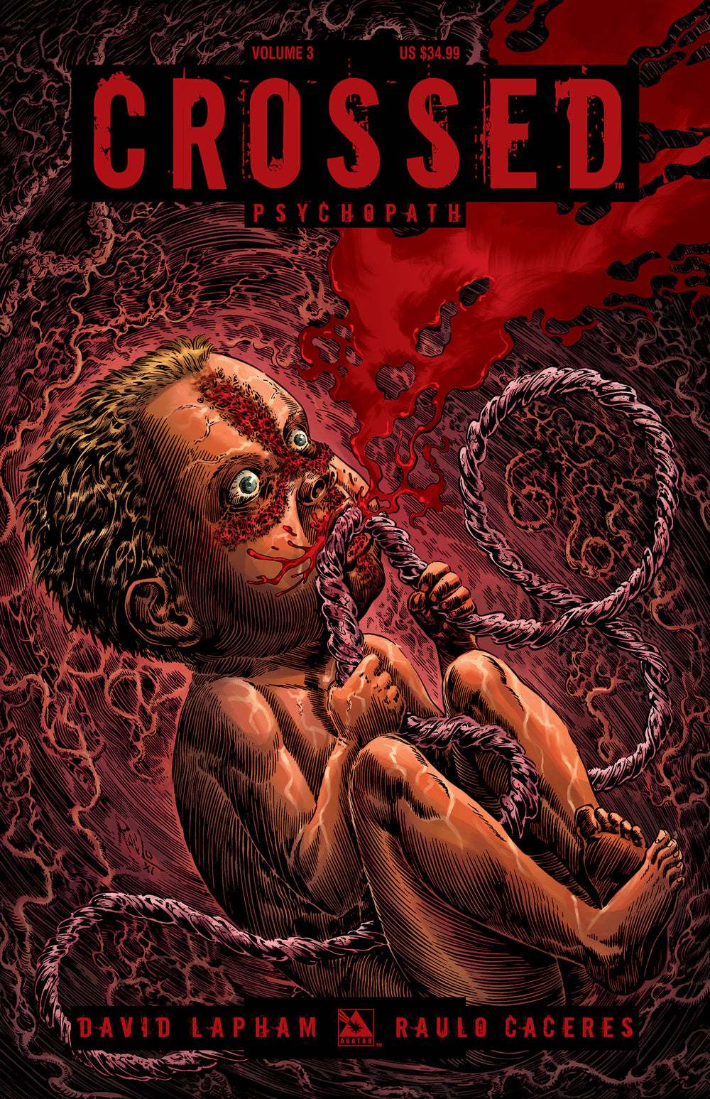 CROSSED HC SGN ED VOL 03 PSYCHOPATH (MR) (C: 0-1-2)